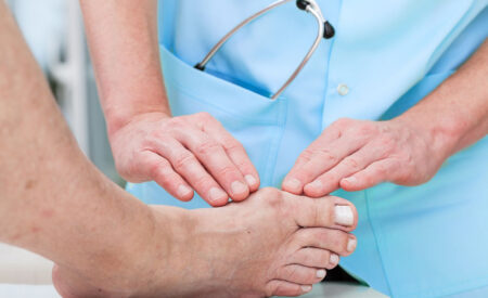 Doctor providing bunions treatment by examining foot