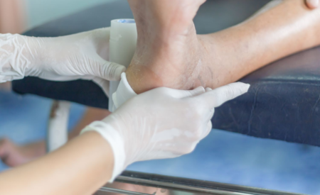 Podiatrist performing wound care for diabetic foot ulcers by applying a sterile bandage to protect the wound and promote healing